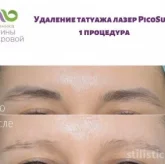 Косметологическая клиника Клиника Бухаровой-Эстетика и Здоровье фото 4
